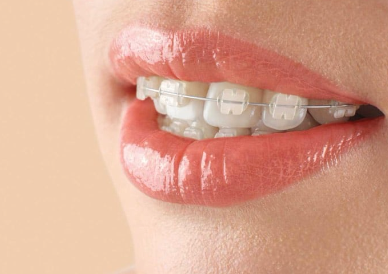 Orthodontic Treatment Support - Smile Map