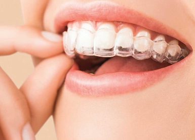 ClinCheck Plan - Smile Map